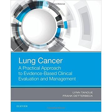 Lung Cancer: A Practical Approach to Evidence-Based Clinical Evaluation and Management