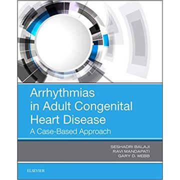 Arrhythmias in Adult Congenital Heart Disease
