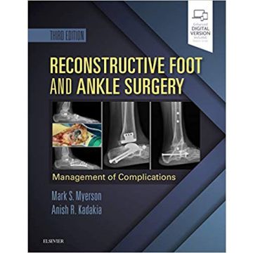 Reconstructive Foot and Ankle Surgery: Management of Complications , 3rd Edition