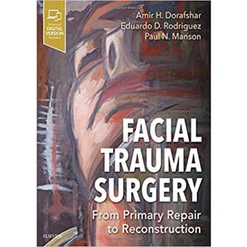 Facial Trauma Surgery - From Primary Repair to Reconstruction
