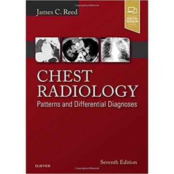 Chest Radiology, 7th Edition - Patterns and Differential Diagnoses