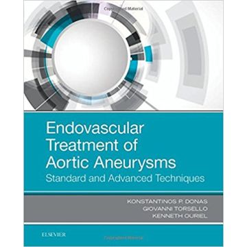 Endovascular Treatment of Aortic Aneurysms - Standard and Advanced Techniques