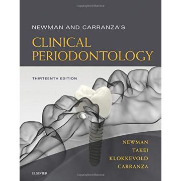 Newman and Carranza's Clinical Periodontology 13th Edition