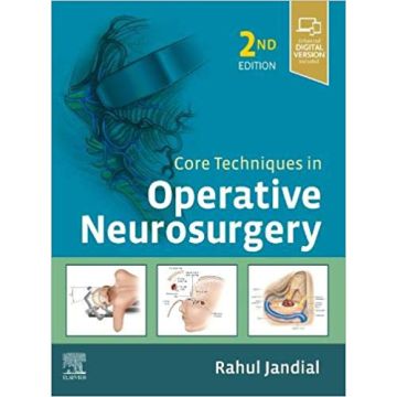 Core Techniques in Operative Neurosurgery, 2nd Edition
