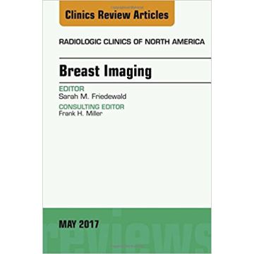 Breast Imaging, An Issue of Radiologic Clinics of North America, Volume 55-3