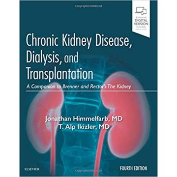 Chronic Kidney Disease, Dialysis, and Transplantation, 4th Edition - A Companion to Brenner and Rector's The Kidney