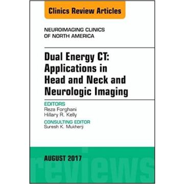 Dual Energy CT: Applications in Head and Neck and Neurologic Imaging, An Issue of Neuroimaging Clinics of North America, Volume 27-3