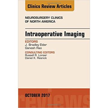 Intraoperative Imaging, An Issue of Neurosurgery Clinics of North America, Volume 28-4