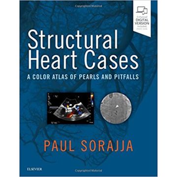 Structural Heart Cases - A Color Atlas of Pearls and Pitfalls