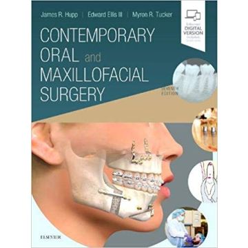 Contemporary Oral and Maxillofacial Surgery, 7th Edition