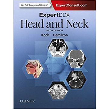 ExpertDDX: Head and Neck, 2nd Edition