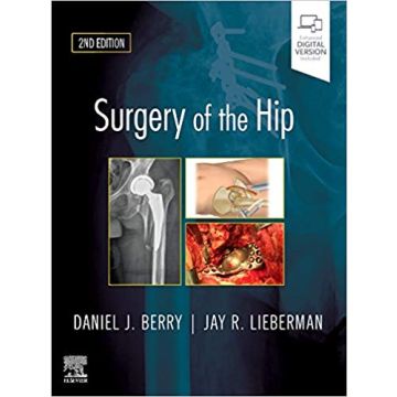 Surgery of the Hip, 2nd Edition