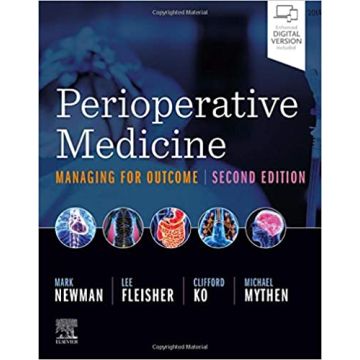Perioperative Medicine, 2nd Edition - Managing for Outcome