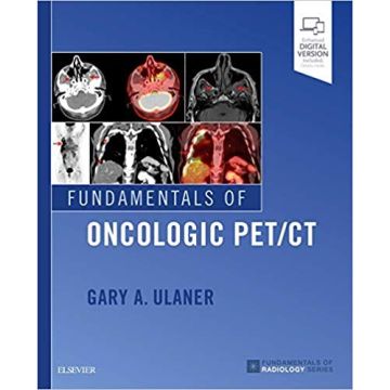 Fundamentals of Oncologic PET/CT