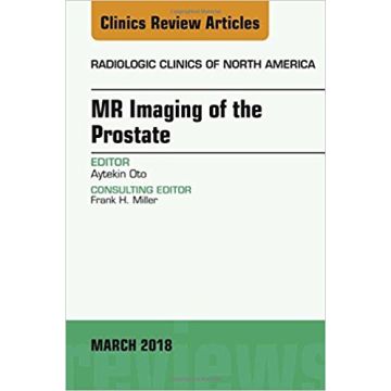 MR Imaging of the Prostate, An Issue of Radiologic Clinics of North America, Volume 56-2