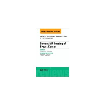 Current MR Imaging of Breast Cancer, An Issue of Magnetic Resonance Imaging Clinics of North America, Volume 26-2