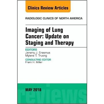 Lung Cancer, An Issue of Radiologic Clinics of North America, Volume 56-3