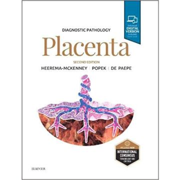 Diagnostic Pathology: Placenta, 2nd Edition