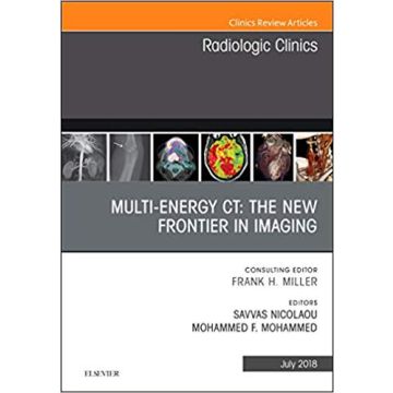 Multi-Energy CT: The New Frontier in Imaging, An Issue of Radiologic Clinics of North America, Volume 56-4