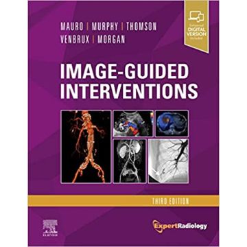 Image-Guided Interventions, 3rd Edition - Expert Radiology Series