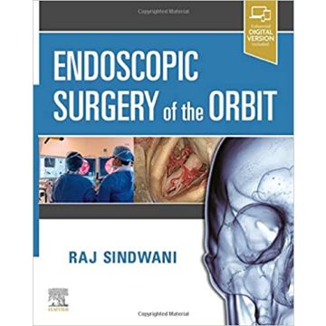Endoscopic Surgery of the Orbit