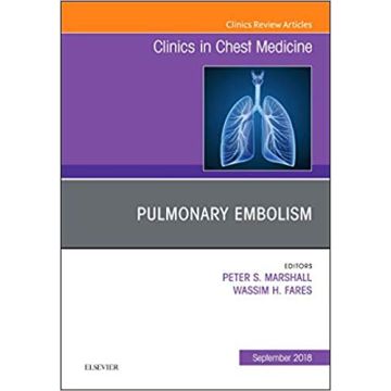 Pulmonary Embolism, An Issue of Clinics in Chest Medicine, Volume 39-3