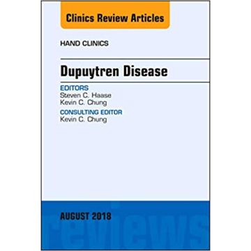 Dupuytren Disease, An Issue of Hand Clinics, Volume 34-3
