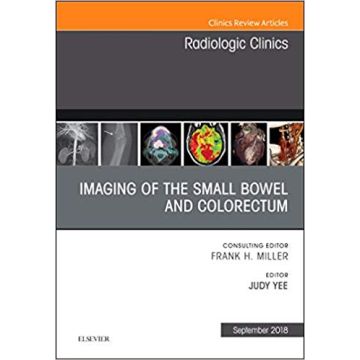 Imaging of the Small Bowel and Colorectum, An Issue of Radiologic Clinics of North America, Volume 56-5