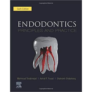 Endodontics, 6th Edition - Principles and Practice
