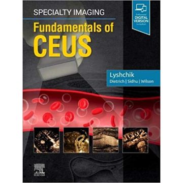 Specialty Imaging: Fundamentals of CEUS