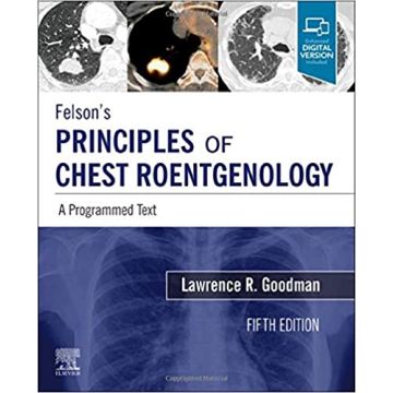 Felson's Principles of Chest Roentgenology, A Programmed Text, 5th Edition - A Programmed Text