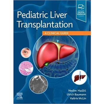 Pediatric Liver Transplantation - A Clinical Guide