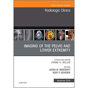 Imaging of the Pelvis and Lower Extremity, An Issue of Radiologic Clinics of North America, Volume 56-6