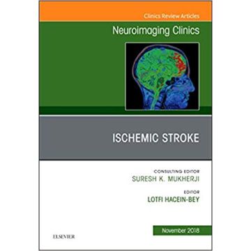 Ischemic Stroke, An Issue of Neuroimaging Clinics of North America, Volume 28-4