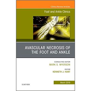 Avascular necrosis of the foot and ankle, An issue of Foot and Ankle Clinics of North America, Volume 24-1