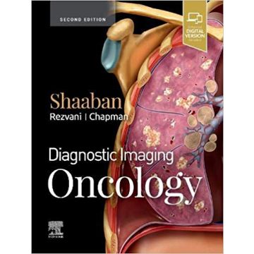 Diagnostic Imaging: Oncology, 2nd Edition
