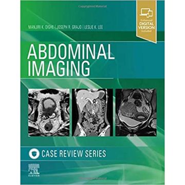 Abdominal Imaging - Case Review Series