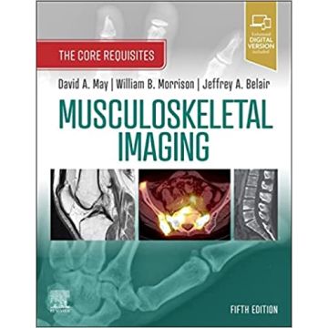 Musculoskeletal Imaging, 5th Edition - The Core Requisites