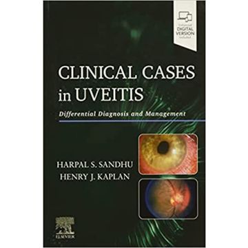 Clinical Cases in Uveitis - Differential Diagnosis and Management 