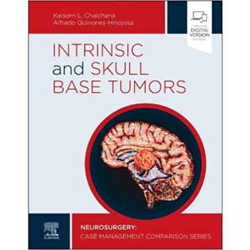 Intrinsic and Skull Base Tumors - Neurosurgery: Case Management Comparison Series