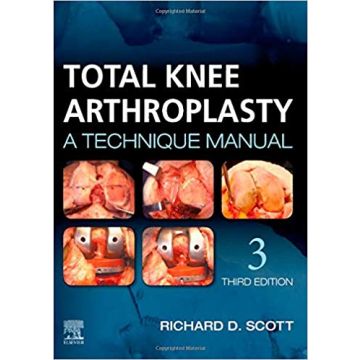 Total Knee Arthroplasty, 3rd Edition - A Technique Manual