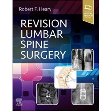 Revision Lumbar Spine Surgery