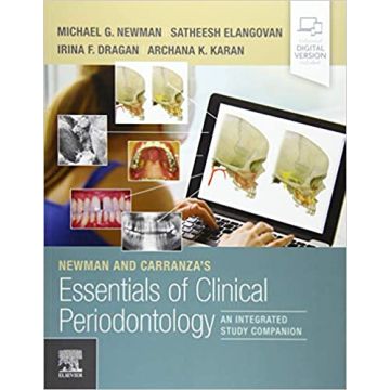 Newman and Carranza's Essentials of Clinical Periodontology