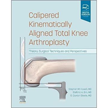 Calipered Kinematically aligned Total Knee Arthroplasty -Theory, Surgical Techniques and Perspectives