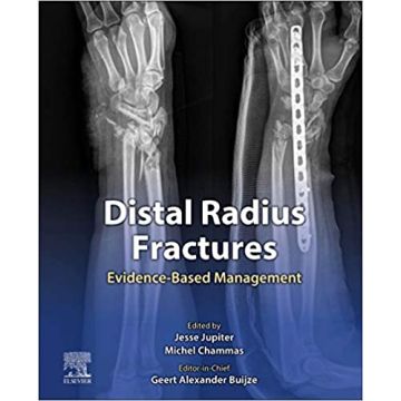 Distal Radius Fractures - Evidence-Based Management