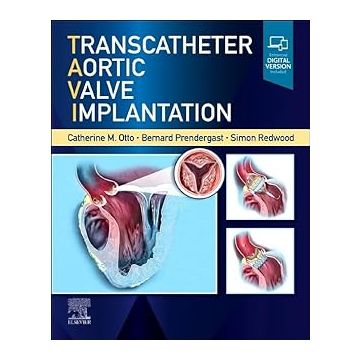 Transcatheter Aortic Valve Implantation