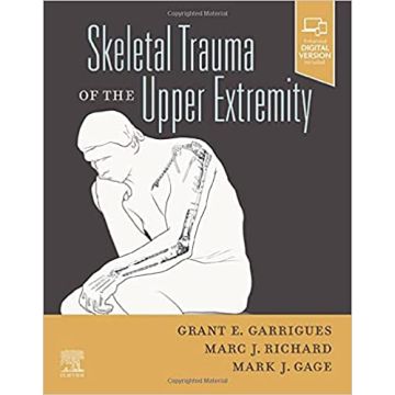 Skeletal Trauma of the Upper Extremity