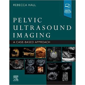 Pelvic Ultrasound Imaging - A Cased-Based Approach