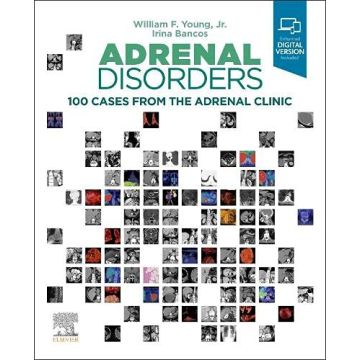 Adrenal Disorders - 100 Cases from the Adrenal Clinic