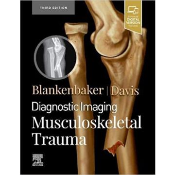Diagnostic Imaging: Musculoskeletal Trauma, 3rd Edition